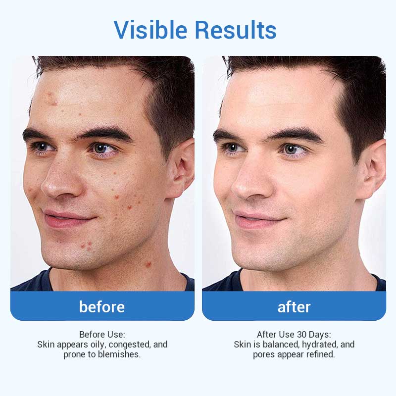 private label men pore balancing toner